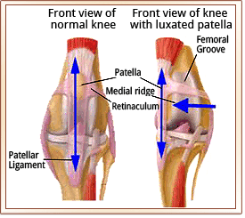 patellar luxation