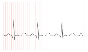 ECG-2